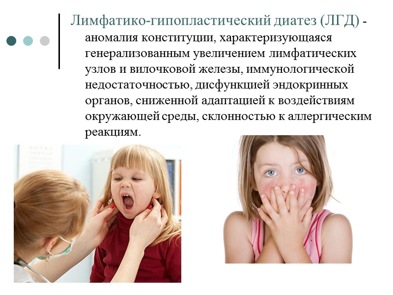 Лимфатико-гипопластический диатез (ЛГД) -  аномалия конституции, характеризующаяся генерализованным увеличением лимфатических узлов и вилочковой